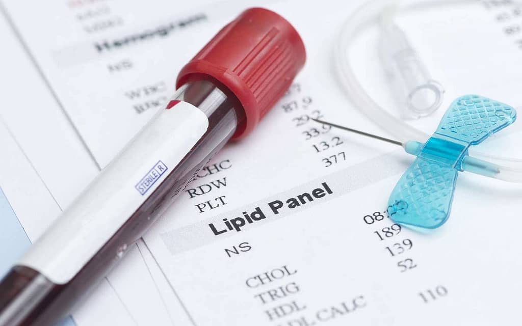 LDL cholesterol